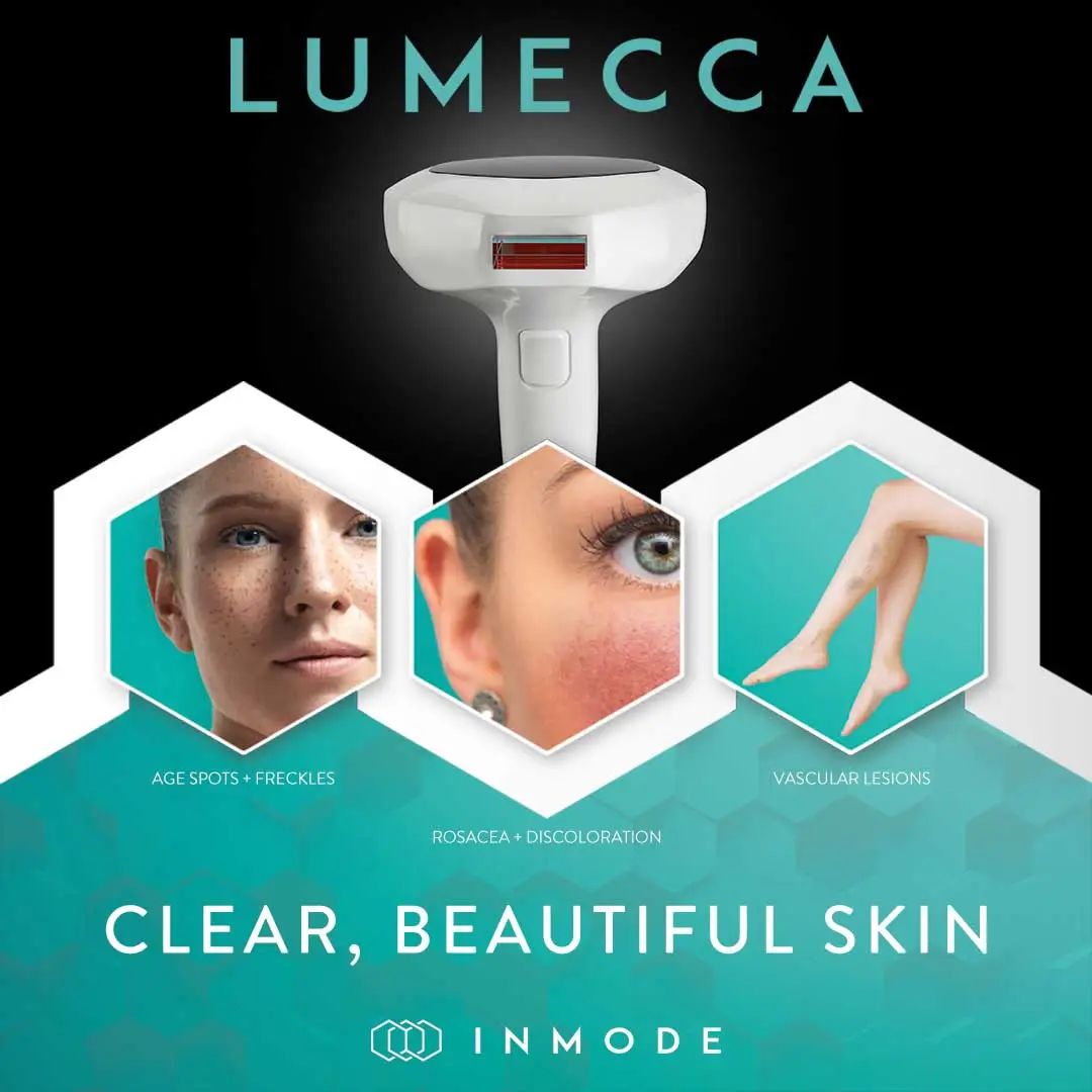 Lumecca IPL Treatment in Portsmouth, NH at Hera Skin and Wellness