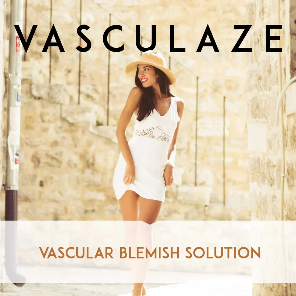 vasculaze