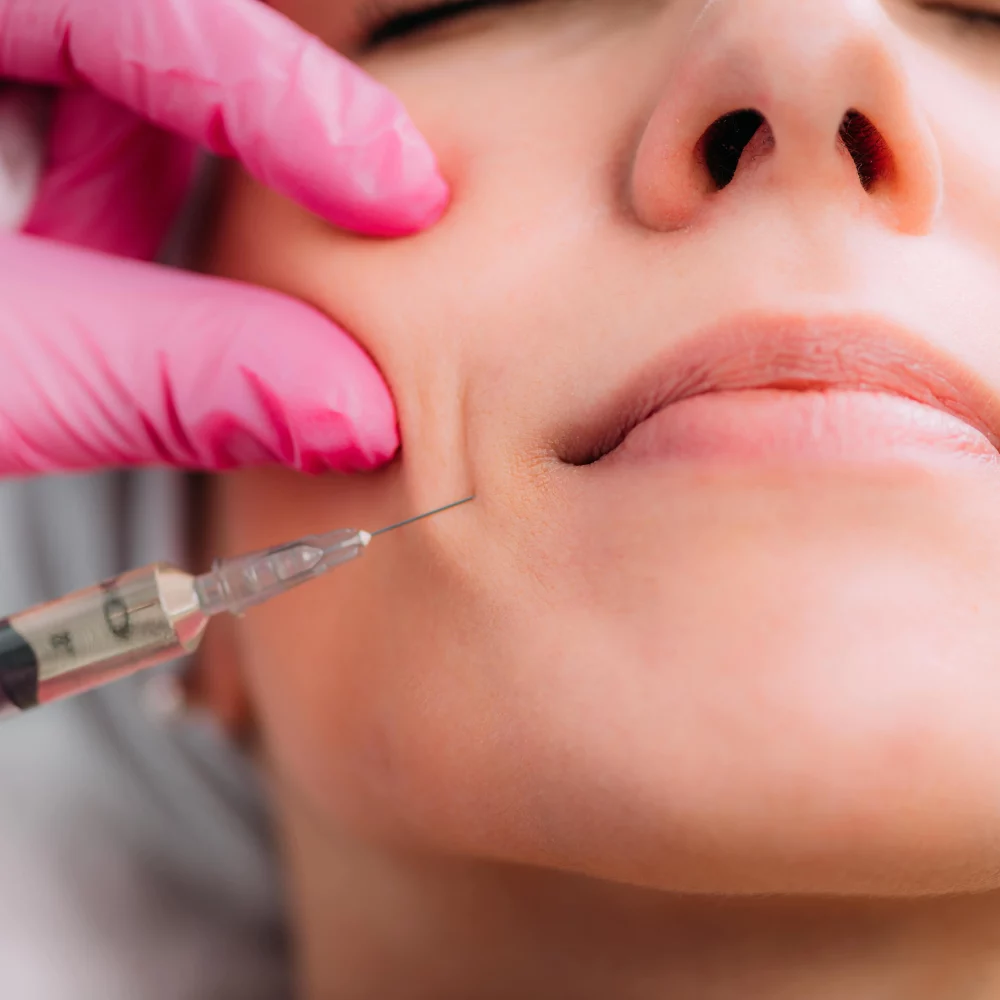 Dermal Filler